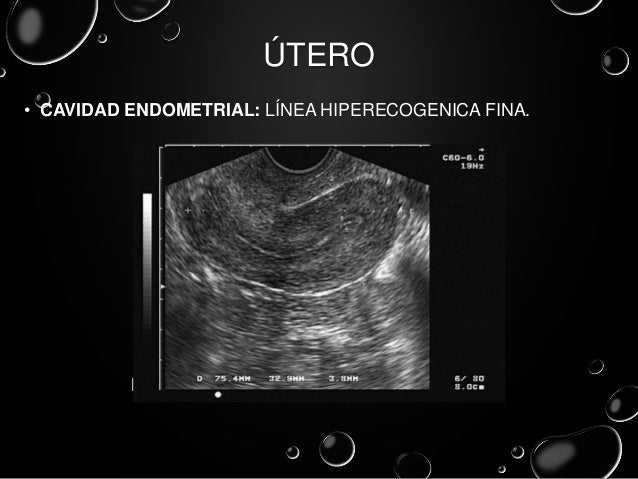 ultrasonidos pelvicos