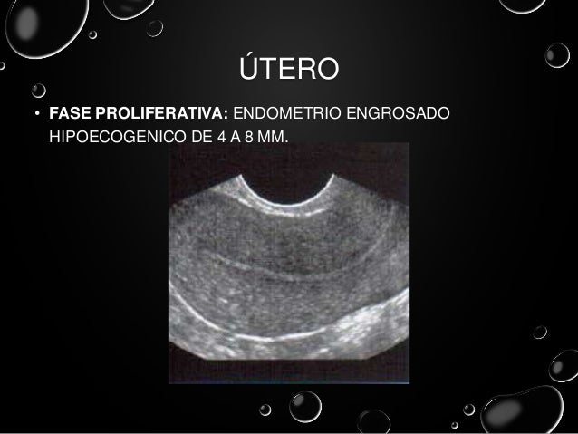 ultrasonidos pelvicos