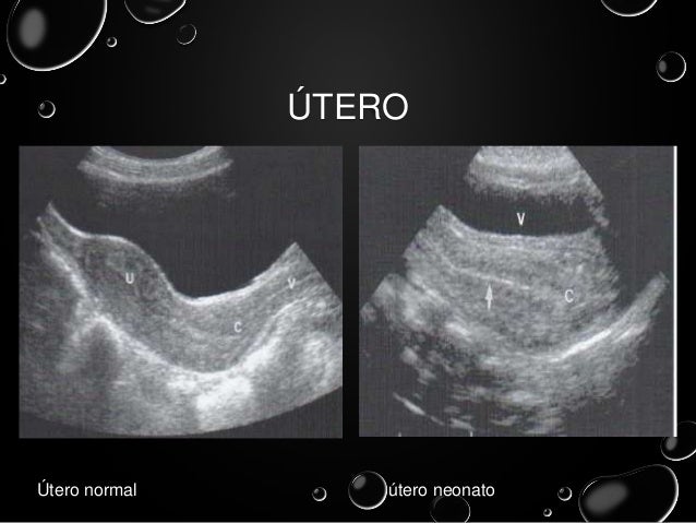 ultrasonidos pelvicos