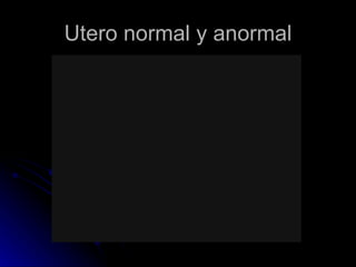 Utero normal y anormal 