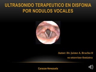 ULTRASONIDO TERAPEUTICO EN DISFONIA 
POR NODULOS VOCALES 
Autor: Dr. Jaime A. Bracho O 
MD otorrino-foniatra 
Caracas-Venezuela 
 