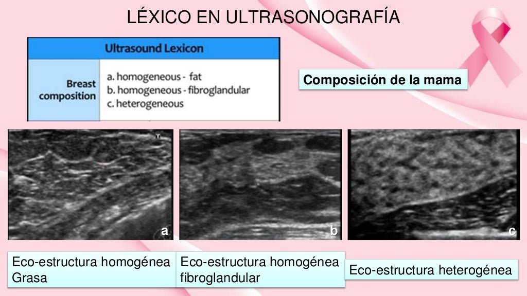 Ultrasonografia de mama