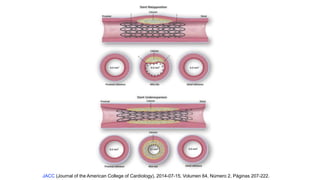 JACC (Journal of the American College of Cardiology), 2014-07-15, Volumen 64, Número 2, Páginas 207-222.
 