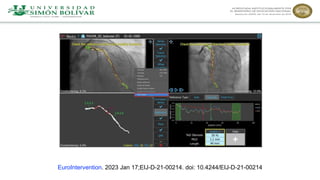 EuroIntervention. 2023 Jan 17;EIJ-D-21-00214. doi: 10.4244/EIJ-D-21-00214
 