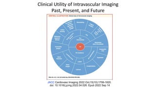 Clinical Utility of Intravascular Imaging
Past, Present, and Future
JACC Cardiovasc Imaging 2022 Oct;15(10):1799-1820.
doi: 10.1016/j.jcmg.2022.04.026. Epub 2022 Sep 14
 