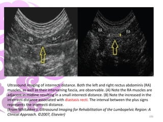 Rehabilitative Ultrasound Imaging: A musculoskeletal Perspective | PPT