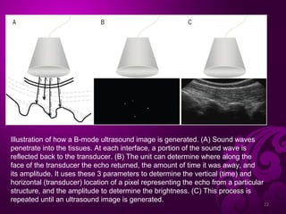 Rehabilitative Ultrasound Imaging: A musculoskeletal Perspective | PPT