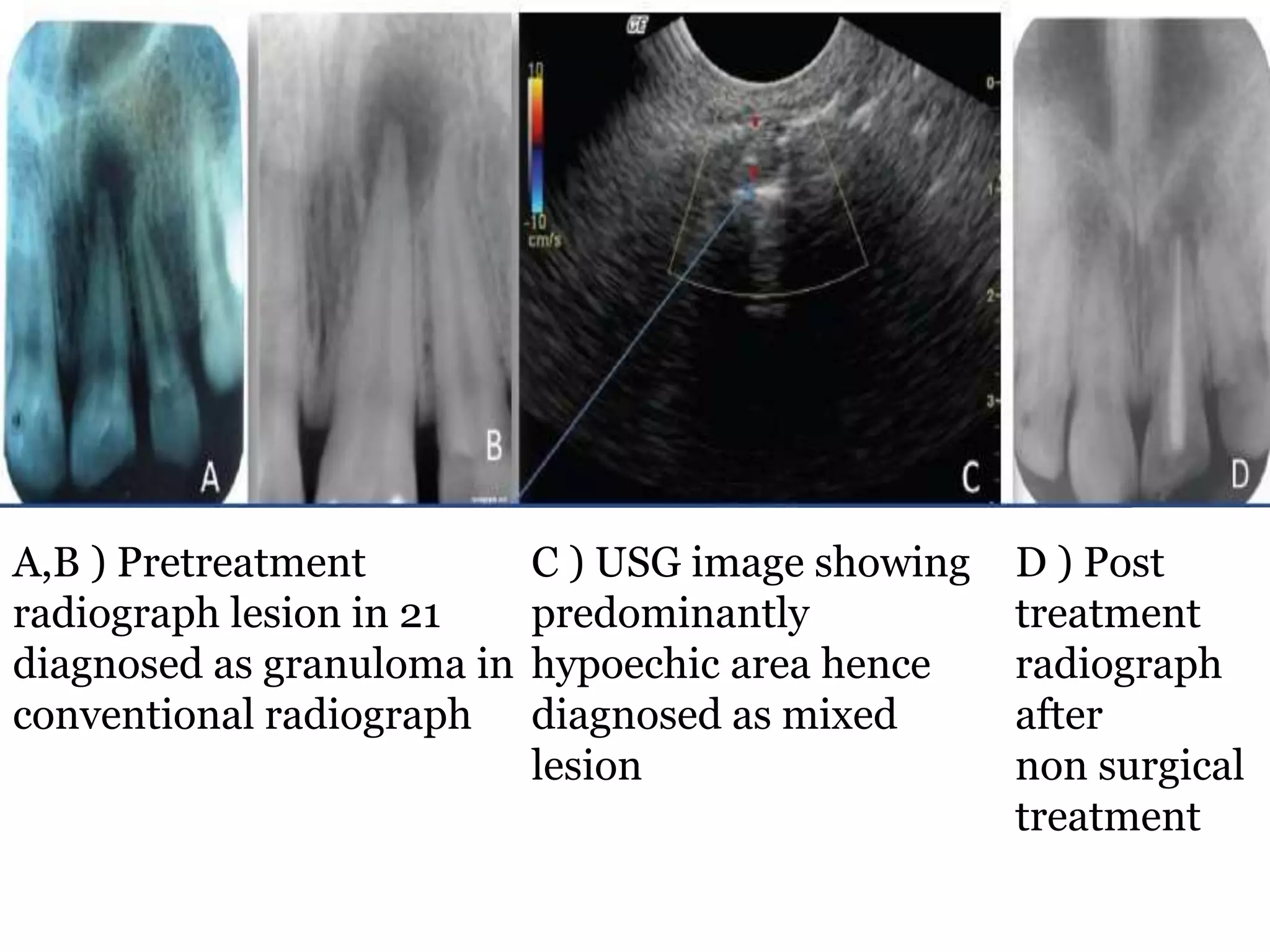 Ultrasonography | PPTX