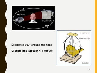  Rotates 360° around the head
 Scan time typically < 1 minute
12
 