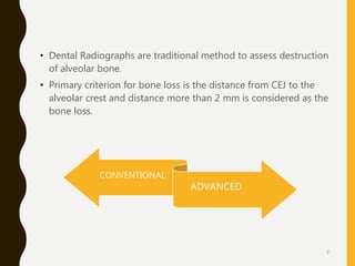 • Dental Radiographs are traditional method to assess destruction
of alveolar bone.
• Primary criterion for bone loss is t...