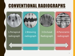CONVENTIONAL RADIOGRAPHS
1.Periapical
radiograph
2.Bitewing
radiograph
3.Occlusal
Radiograph
4.Panoramic
radiograph
8
 