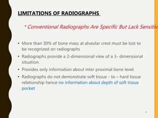 • More than 30% of bone mass at alveolar crest must be lost to
be recognized on radiographs
• Radiographs provide a 2-dime...