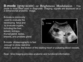 B-mode (gray-scale) or Brightness Modulation : This
mode is most often used in diagnostic imaging; signals are displayed as a
2-dimensional anatomic image.
B-mode is commonly
used to evaluate the
developing fetus and
to evaluate organs,
including the liver,
spleen, kidneys,
thyroid gland, testes,
breasts, and prostate gland.
B-mode ultrasonography is fast
enough to show real-time
motion, such as the motion of the beating heart or pulsating blood vessels.
Real- time imaging provides anatomic and functional information.
 