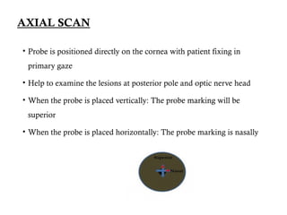 ULTRASONOGRAPHY, its types, A scan and B scan biomicroscopy | PPTX