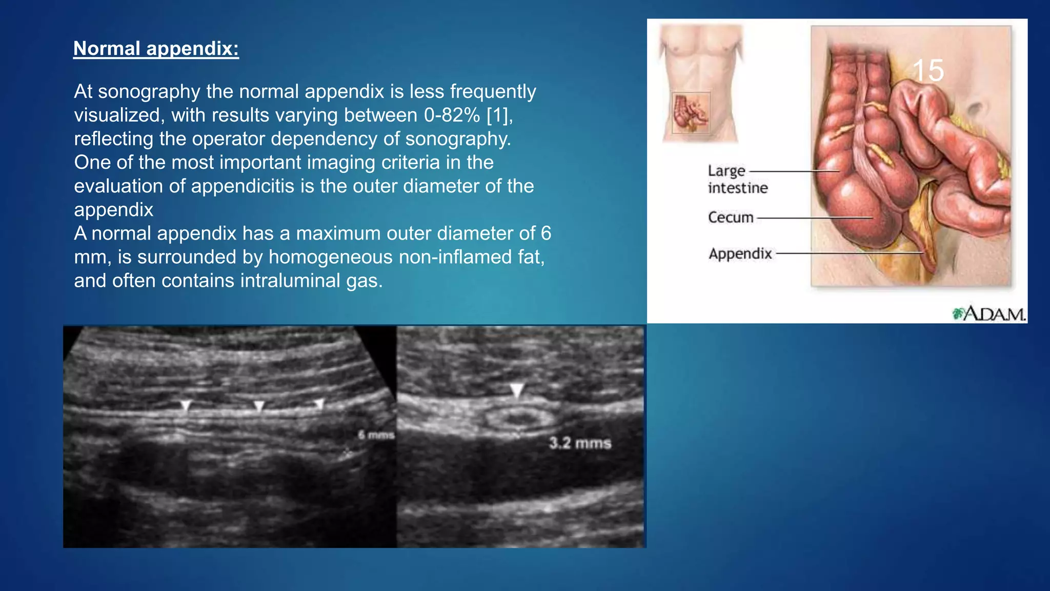 Ultrasonography in Acute Abdomen | PPTX