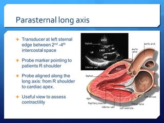 Parasternal long axis
 Transducer at left sternal
edge between 2nd -4th
intercostal space
 Probe marker pointing to
patients R shoulder
 Probe aligned along the
long axis: from R shoulder
to cardiac apex.
 Useful view to assess
contractility
 