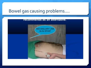 Bowel gas causing problems….
 