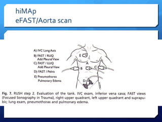hiMAp
eFAST/Aorta scan
 