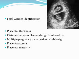  Fetal Gender Identification
 Placental thickness
 Distance between placental edge & internal os
 Multiple pregnancy: twin peak or lambda sign
 Placenta accreta
 Placental maturity
 