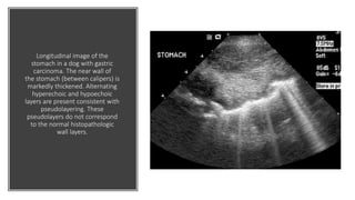 Longitudinal image of the
stomach in a dog with gastric
carcinoma. The near wall of
the stomach (between calipers) is
markedly thickened. Alternating
hyperechoic and hypoechoic
layers are present consistent with
pseudolayering. These
pseudolayers do not correspond
to the normal histopathologic
wall layers.
 
