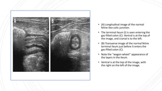 • (A) Longitudinal image of the normal
feline ileo-colic junction.
• The terminal ileum (I) is seen entering the
gas-filled colon (C). Ventral is at the top of
the image, and cranial is to the left.
• (B) Transverse image of the normal feline
terminal ileum just before it enters the
gas-filled colon (C).
• Note the ‘‘wagon-wheel’’ appearance of
the layers in the ileum.
• Ventral is at the top of the image, with
the right on the left of the image.
 