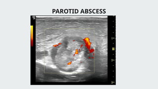 Ultrasonography: Basics and applications in dentistry | PPTX