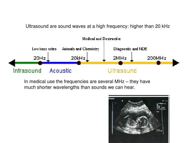 Ultrasound