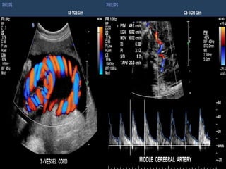 Ultrasound