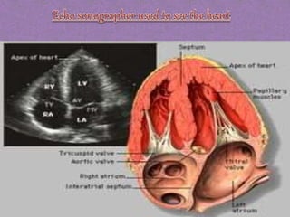 Ultrasound
