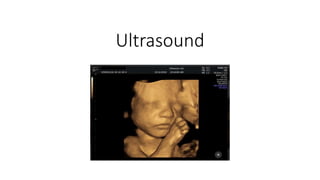 Ultrasound
 