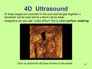 Ultrasound powerpoint presentation radio | PPT
