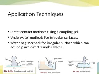 Direct Contact Method ULTRASOUND PHYSIOTHERAPY MANAGEMENT NOTES.pptx