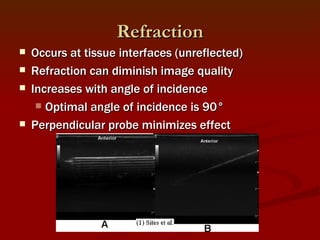 Ultrasound And Regional Anesthesia Feb 2009 | PPT