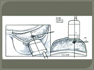 ultrasound-guided-breast-core-biopsy-ppt