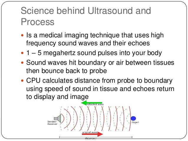 ultrasound mehar how ultrasound imaging works