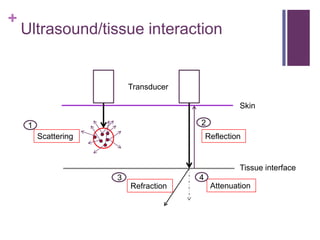 Ultrasound | PPTX