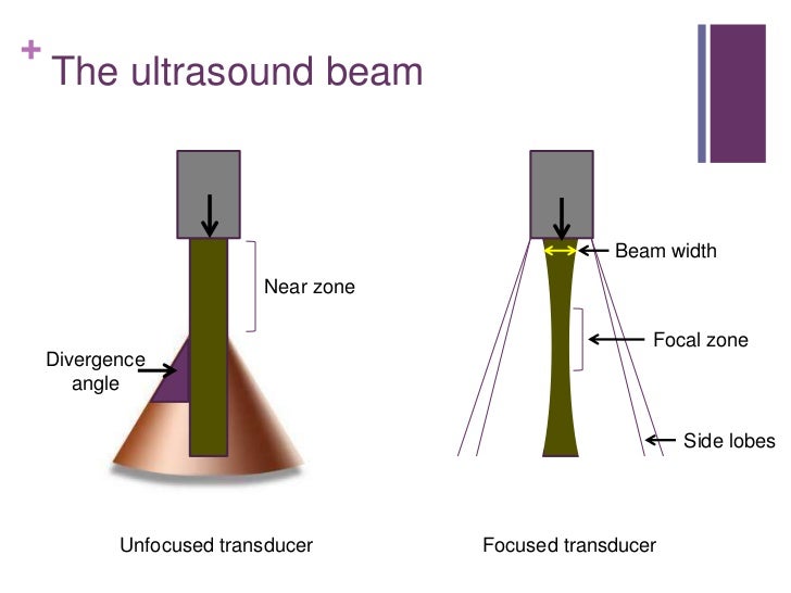 Ultrasound