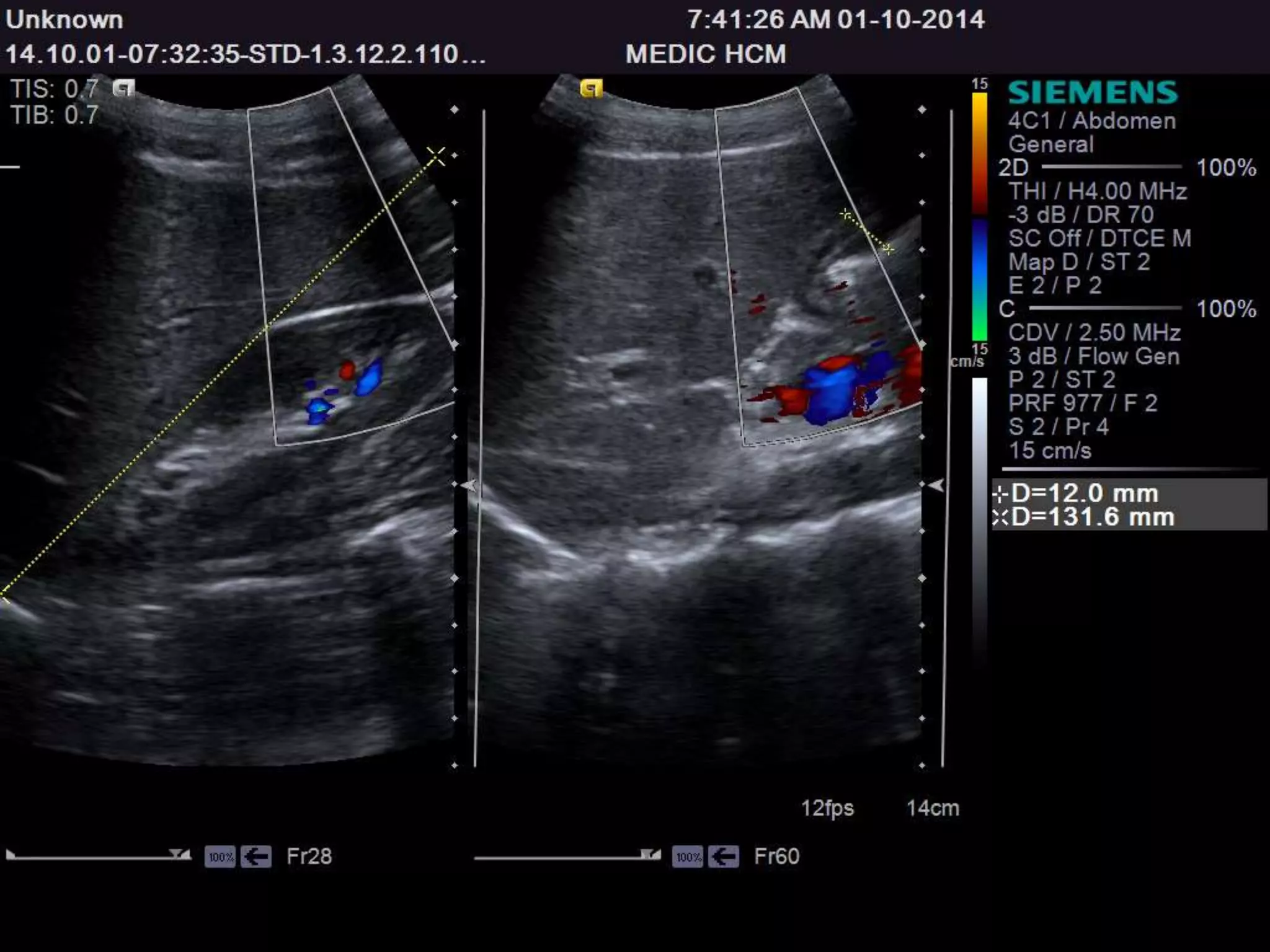 Ultrasound Anatomy for 1st- and 2nd- year Medical Students of Tan Tao ...