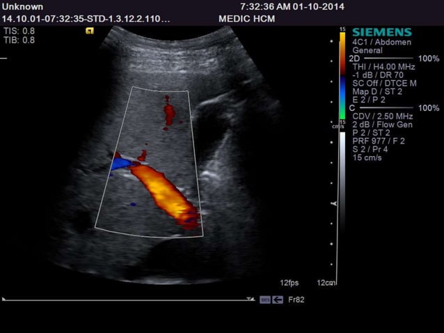 Ultrasound Anatomy for 1st- and 2nd- year Medical Students of Tan Tao ...