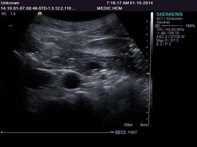 Ultrasound Anatomy for 1st- and 2nd- year Medical Students of Tan Tao ...
