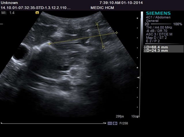 Ultrasound Anatomy for 1st- and 2nd- year Medical Students of Tan Tao ...