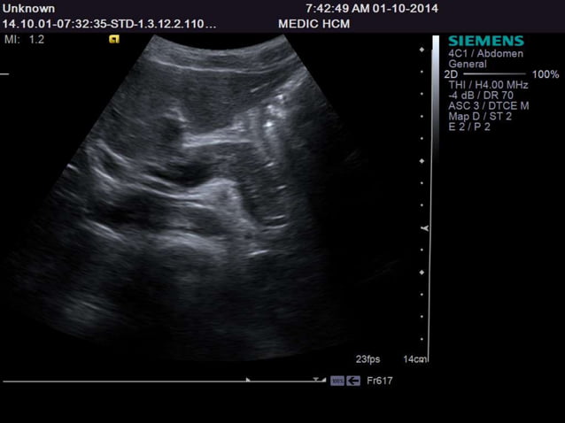 Ultrasound Anatomy for 1st- and 2nd- year Medical Students of Tan Tao ...