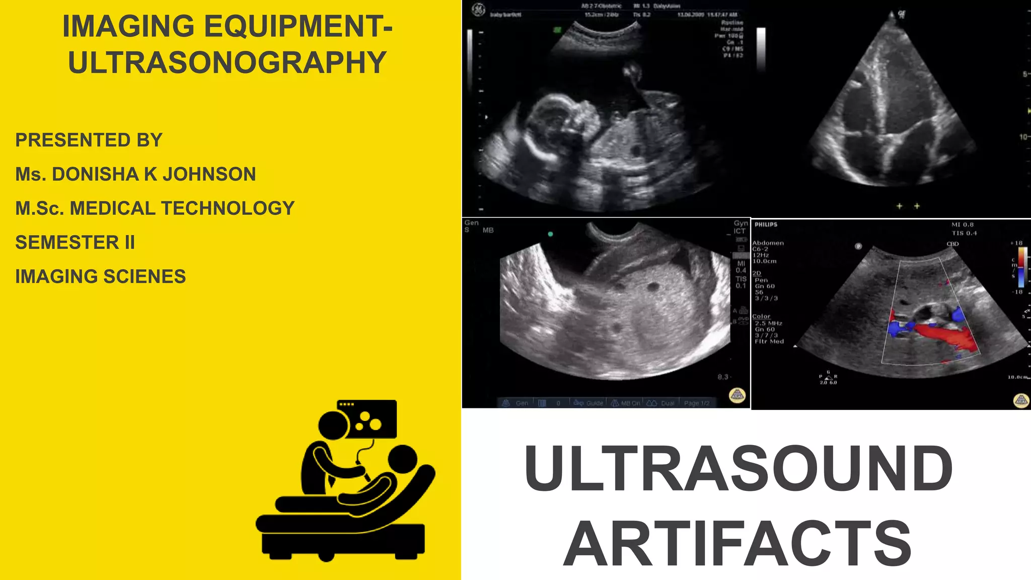 Ultrasound artifacts | PPTX