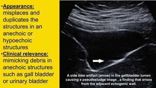 Ultrasound artifacts | PPTX