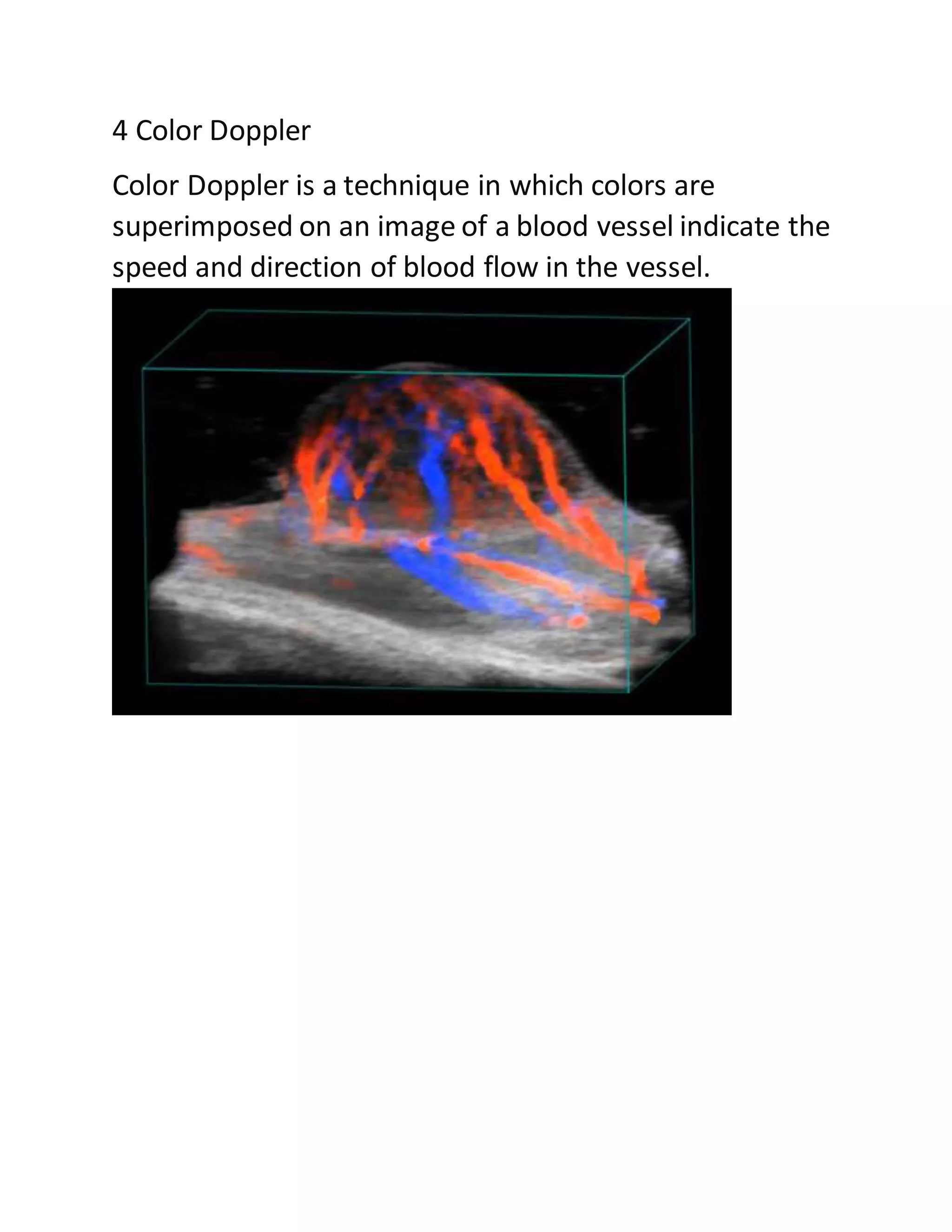 Ultrasound assignment 3 mark question and answer | DOCX