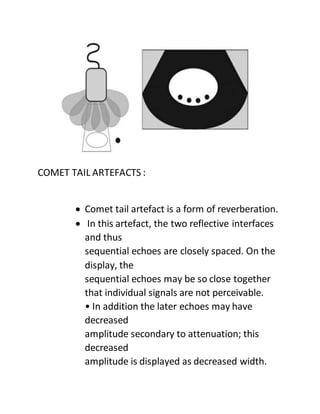 COMET TAIL ARTEFACTS :
 Comet tail artefact is a form of reverberation.
 In this artefact, the two reflective interfaces
and thus
sequential echoes are closely spaced. On the
display, the
sequential echoes may be so close together
that individual signals are not perceivable.
• In addition the later echoes may have
decreased
amplitude secondary to attenuation; this
decreased
amplitude is displayed as decreased width.
 
