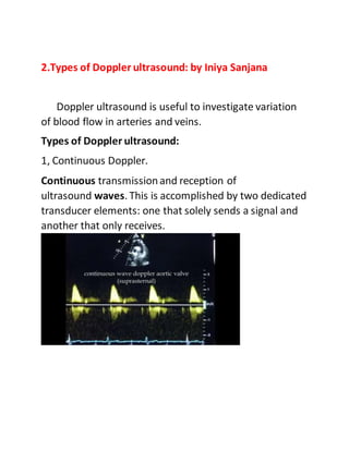 2.Types of Doppler ultrasound: by Iniya Sanjana
Doppler ultrasound is useful to investigate variation
of blood flow in arteries and veins.
Types of Doppler ultrasound:
1, Continuous Doppler.
Continuous transmissionand reception of
ultrasound waves. This is accomplished by two dedicated
transducer elements: one that solely sends a signal and
another that only receives.
 