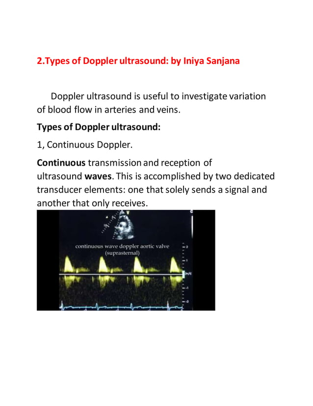 Ultrasound assignment 3 mark question and answer | DOCX
