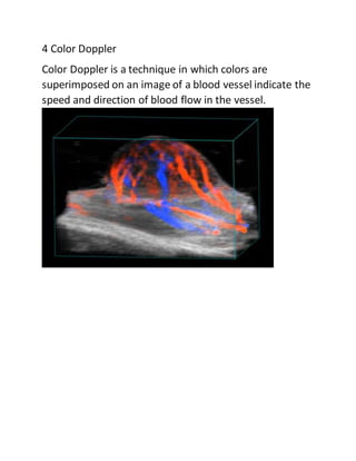 4 Color Doppler
Color Doppler is a technique in which colors are
superimposed on an image of a blood vessel indicate the
speed and direction of blood flow in the vessel.
 