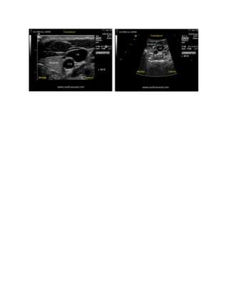 Ultrasound assignment 3 mark question and answer 